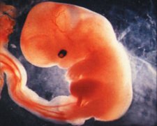 <b>怀孕多久能看见胚胎？</b>